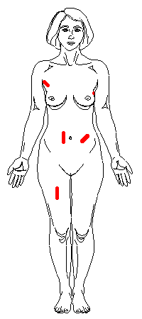Female: Anterior Measurement Sites