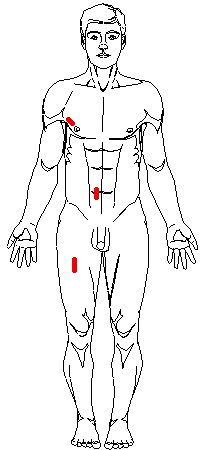Male: Anterior Measurement Sites