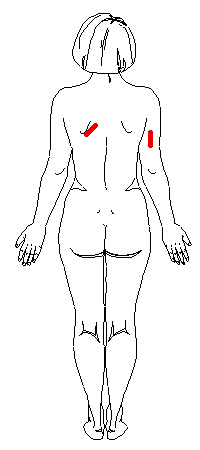 Female: Posterior Measurement Sites