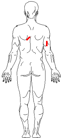 Male: Posterior Measurement Sites